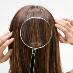 Лечение волос: профессиональные рекомендации и советы трихологов