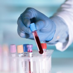 Зачем нужно регулярно сдавать анализ крови в клинике?